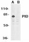 Neural Proliferation, Differentiation And Control 1 antibody, orb108939, Biorbyt, Western Blot image 