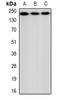 Chromodomain Helicase DNA Binding Protein 4 antibody, orb382463, Biorbyt, Western Blot image 