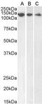 DNA damage-binding protein 1 antibody, 45-048, ProSci, Western Blot image 