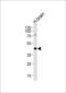 ELAV Like RNA Binding Protein 3 antibody, MBS9214452, MyBioSource, Western Blot image 