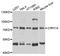 UTP4 Small Subunit Processome Component antibody, A11262, Boster Biological Technology, Western Blot image 