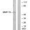 Matrix Metallopeptidase 19 antibody, A05171, Boster Biological Technology, Western Blot image 