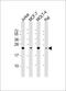 O-6-Methylguanine-DNA Methyltransferase antibody, M01012-2, Boster Biological Technology, Western Blot image 