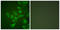 TIMP Metallopeptidase Inhibitor 2 antibody, LS-C118596, Lifespan Biosciences, Immunofluorescence image 