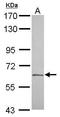 Coagulation Factor XI antibody, GTX113690, GeneTex, Western Blot image 