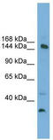 Mediator Complex Subunit 14 antibody, TA344438, Origene, Western Blot image 