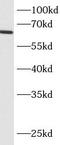 Beta,beta-carotene 9 ,10 -oxygenase antibody, FNab00852, FineTest, Western Blot image 