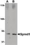 Sprouty Related EVH1 Domain Containing 1 antibody, PA5-20618, Invitrogen Antibodies, Western Blot image 