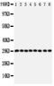 Cytokine Inducible SH2 Containing Protein antibody, PA1786, Boster Biological Technology, Western Blot image 