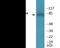 Death Domain Associated Protein antibody, EKC2026, Boster Biological Technology, Western Blot image 