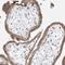 Taspase 1 antibody, NBP1-88306, Novus Biologicals, Immunohistochemistry paraffin image 