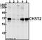 Carbohydrate sulfotransferase 2 antibody, A08119-1, Boster Biological Technology, Western Blot image 