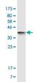 Neuroligin-4, X-linked antibody, H00057502-M01A-200ul, Novus Biologicals, Western Blot image 