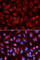 Adenosine Deaminase antibody, A1019, ABclonal Technology, Immunofluorescence image 