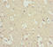 Inositol Polyphosphate-4-Phosphatase Type I A antibody, LS-C675905, Lifespan Biosciences, Immunohistochemistry paraffin image 