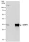 Insulin Like Growth Factor Binding Protein 1 antibody, PA5-78020, Invitrogen Antibodies, Immunoprecipitation image 