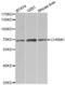 Cholinergic Receptor Muscarinic 5 antibody, abx004108, Abbexa, Western Blot image 