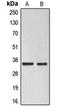 ELOVL Fatty Acid Elongase 6 antibody, orb215284, Biorbyt, Western Blot image 