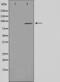 Aryl Hydrocarbon Receptor antibody, GTX52358, GeneTex, Western Blot image 