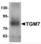 Transglutaminase 7 antibody, NBP2-81763, Novus Biologicals, Western Blot image 