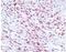 ORF73 antibody, NBP1-30176, Novus Biologicals, Immunohistochemistry frozen image 