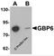 Guanylate Binding Protein Family Member 6 antibody, 6707, ProSci, Western Blot image 