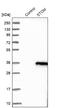 Stomatin antibody, NBP1-88561, Novus Biologicals, Western Blot image 