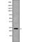 ATP Synthase Peripheral Stalk Subunit OSCP antibody, PA5-68104, Invitrogen Antibodies, Western Blot image 