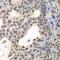 Centromere Protein C antibody, GTX32516, GeneTex, Immunohistochemistry paraffin image 