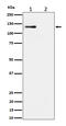 Minichromosome Maintenance Complex Component 2 antibody, P00374-2, Boster Biological Technology, Western Blot image 