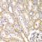 Bone Morphogenetic Protein Receptor Type 1B antibody, orb48291, Biorbyt, Immunohistochemistry paraffin image 