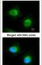 Cofilin 2 antibody, PA5-21287, Invitrogen Antibodies, Immunofluorescence image 