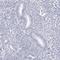 Testis Specific Serine Kinase 1B antibody, HPA027827, Atlas Antibodies, Immunohistochemistry frozen image 