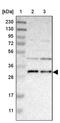 Transmembrane Protein 17 antibody, PA5-53723, Invitrogen Antibodies, Western Blot image 
