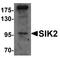 Salt Inducible Kinase 2 antibody, A04515, Boster Biological Technology, Western Blot image 
