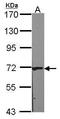 Carnitine O-Acetyltransferase antibody, PA5-29996, Invitrogen Antibodies, Western Blot image 