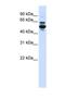 Cytochrome P450 Family 3 Subfamily A Member 43 antibody, NBP1-69413, Novus Biologicals, Western Blot image 