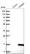 V-Set Pre-B Cell Surrogate Light Chain 3 antibody, NBP1-89347, Novus Biologicals, Western Blot image 