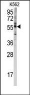 Cytochrome P450 Family 4 Subfamily F Member 8 antibody, AP14742PU-N, Origene, Western Blot image 