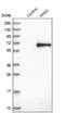 Kininogen 1 antibody, NBP1-89993, Novus Biologicals, Western Blot image 