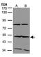 ISG-54 K antibody, NBP1-31164, Novus Biologicals, Western Blot image 