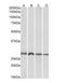 Siah E3 Ubiquitin Protein Ligase 1 antibody, orb18357, Biorbyt, Western Blot image 