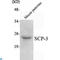 Synaptonemal Complex Protein 3 antibody, LS-C814120, Lifespan Biosciences, Western Blot image 