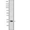 Cytidine/Uridine Monophosphate Kinase 1 antibody, abx149417, Abbexa, Western Blot image 