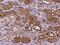 Dihydrouridine Synthase 1 Like antibody, 201799-T08, Sino Biological, Immunohistochemistry paraffin image 