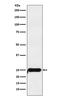 Catechol-O-Methyltransferase antibody, M00464-2, Boster Biological Technology, Western Blot image 