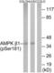 Protein Kinase AMP-Activated Non-Catalytic Subunit Beta 1 antibody, LS-C198627, Lifespan Biosciences, Western Blot image 