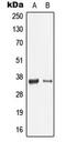Galectin 9 antibody, MBS820334, MyBioSource, Western Blot image 