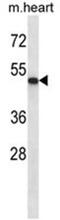 Abl Interactor 2 antibody, AP50030PU-N, Origene, Western Blot image 