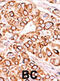Phosphoinositide Kinase, FYVE-Type Zinc Finger Containing antibody, abx033209, Abbexa, Immunohistochemistry frozen image 